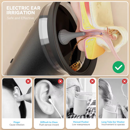Electric Ear Wax Removal System Water Powered Ear Cleaning Tool with Irrigation Flusher 3 Pressure Settings Safe & Effective